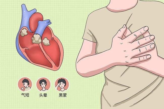 如何识别暴发性心肌炎